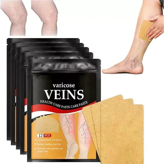 Parches para varices